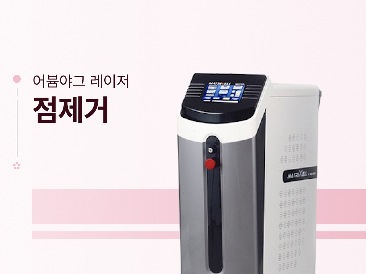 점제거